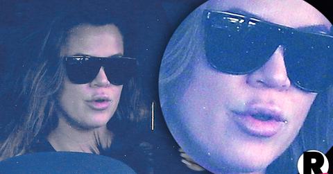 Khloe Kardashian Lip Injection Lies