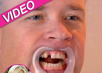 //brooks ayers teeth rhoc