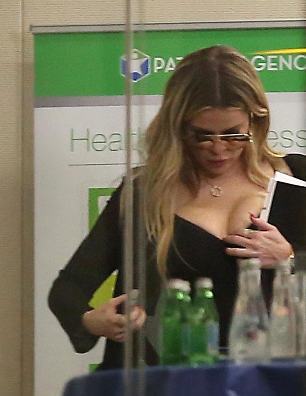 khloe kardashian plastic surgery implants photos