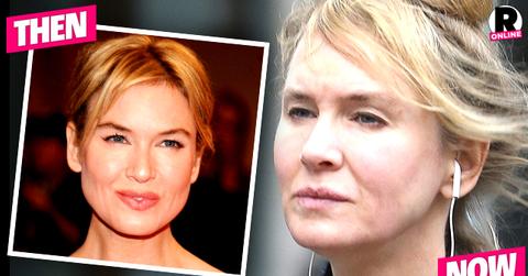 Renee Zellweger Plastic Surgery
