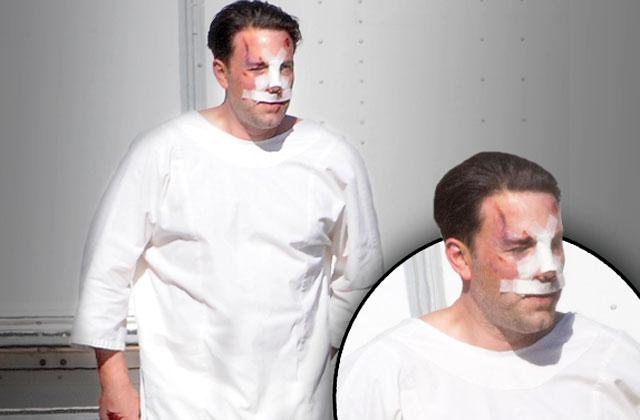 //ben affleck plastic surgery rumors bloody on set pp