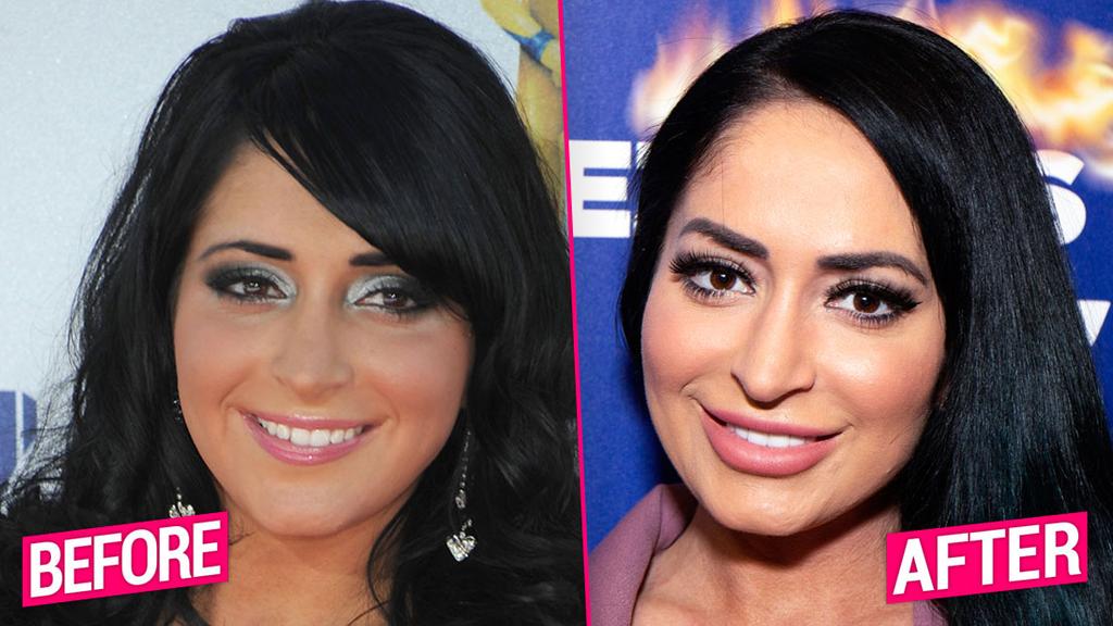 Jersey Shore Cast S Shocking Plastic Surgery Transformations Revealed