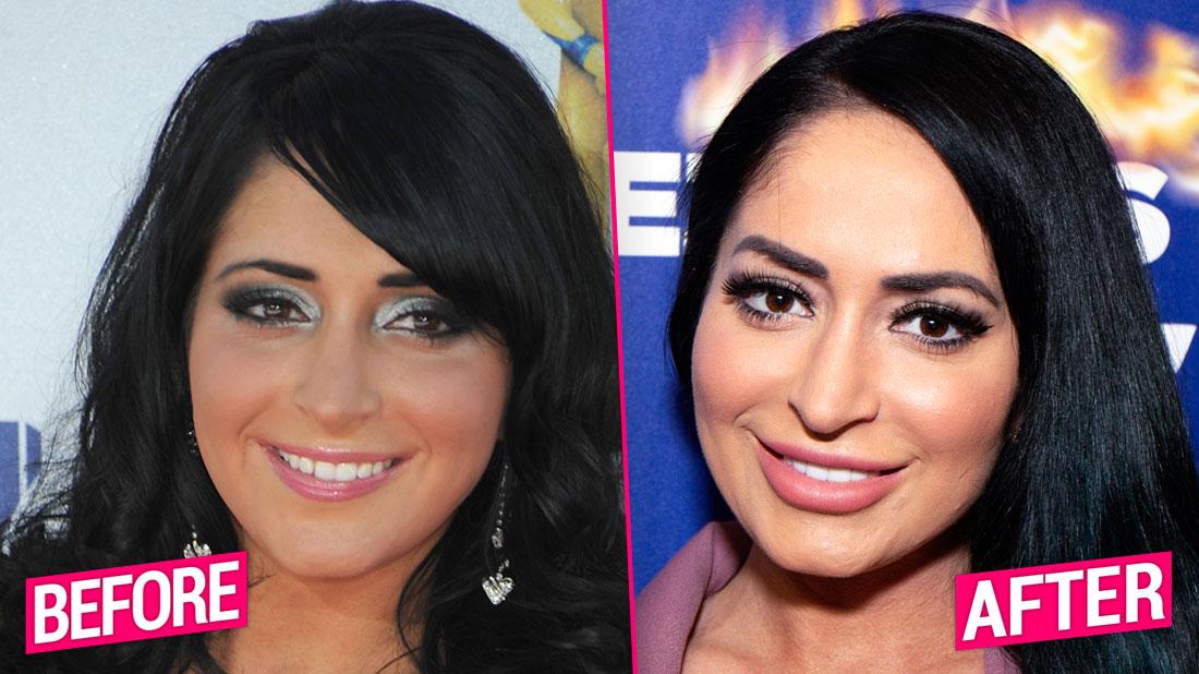 'Jersey Shore' Cast's Shocking Plastic Surgery Transformations Revealed