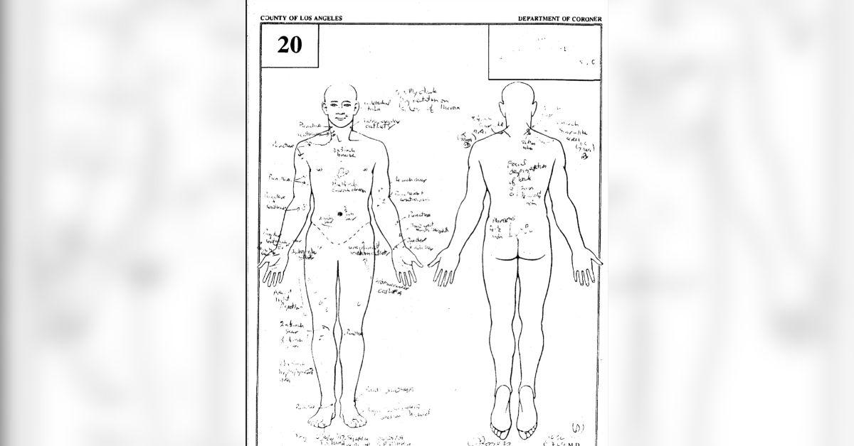 michael jackson autopsy