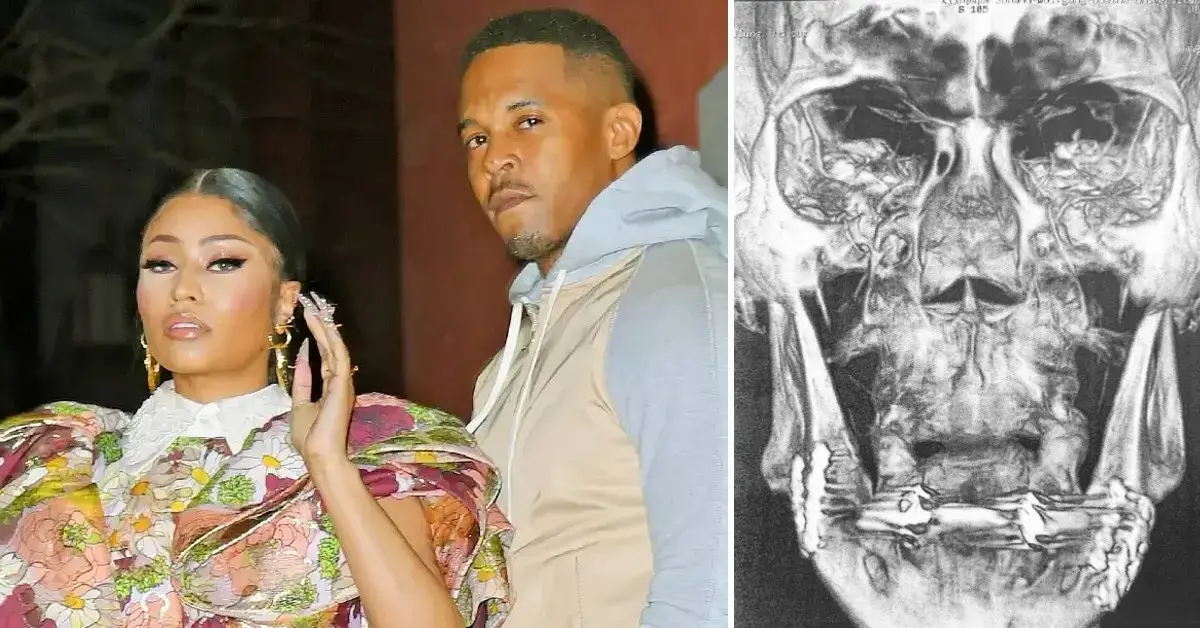 Nicki Minaj Accused of Provoking Husband to Attack Security Guard Despite  Knowing About His 'Violent Past'