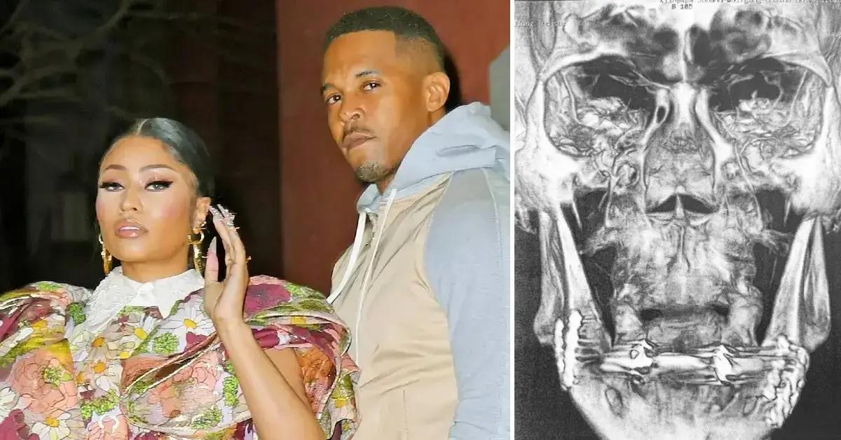 Nicki Minaj Accused of Provoking Husband to Attack Security Guard Despite Knowing About His 'Violent Past' - Vimarsana News