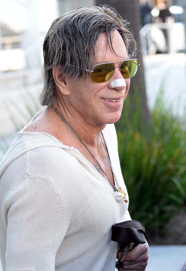 Mickey Rourke Plastic Surgery Photos -- ‘The Wrestler’ Star Bandaged In Beverly Hills