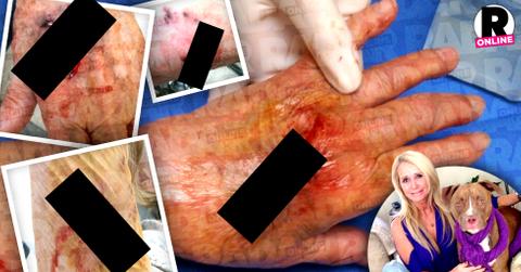 //kim richards pitbull attack victim pp sl