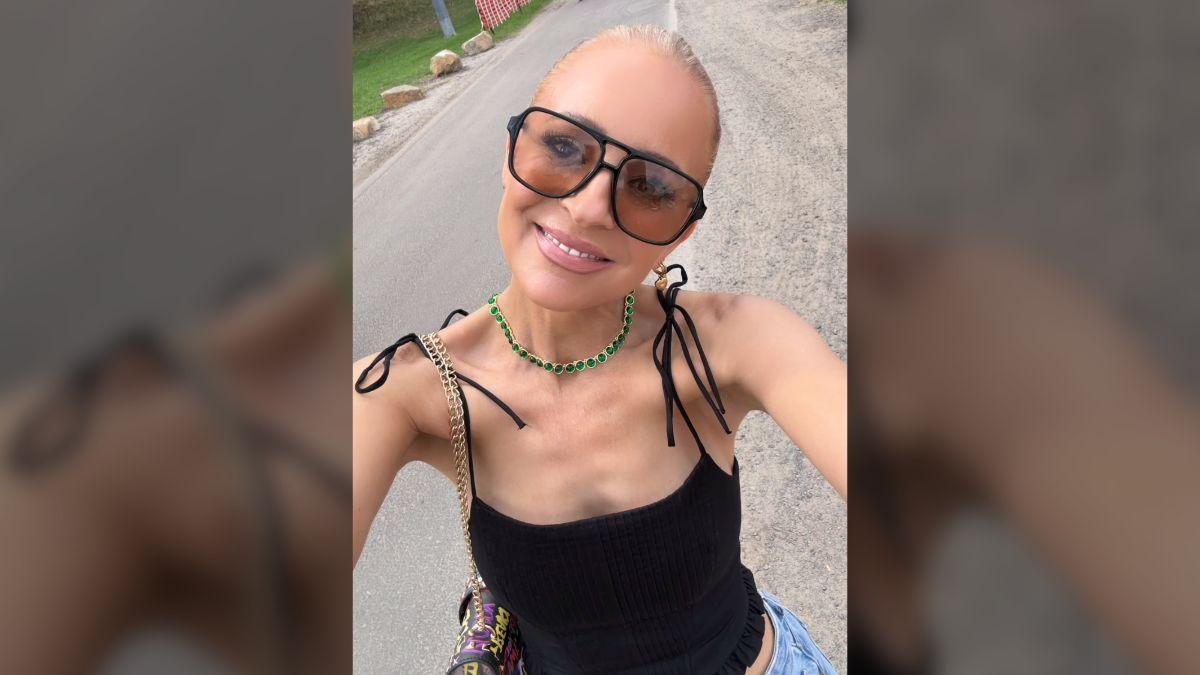 image of Fans flooded her comments with support after seeing the shocking injury photos.