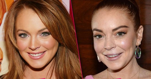 Lindsay Lohan Plastic Surgery