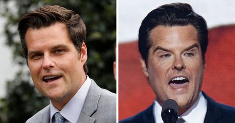 What Is Happening With Matt Gaetz's Rubbery Face? See Congressman's Astonishing Transformation From Chubby to 'Botoxed Blow-Up Doll'