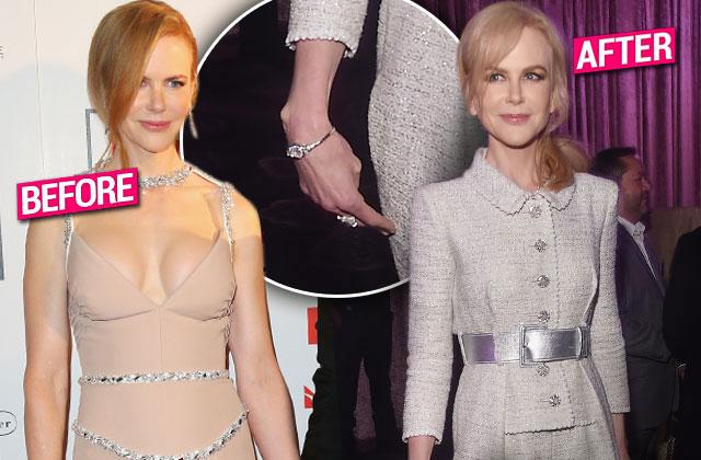 Nicole Kidman Skinny Weight Loss Photos -- Face Plastic Surgery