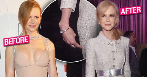 //nicole kidman skinny weight loss face plastic surgery