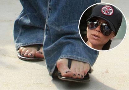 Celebs With Ugly Feet