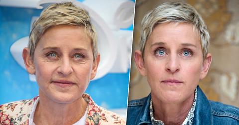 Ellen DeGeneres Plastic Surgery
