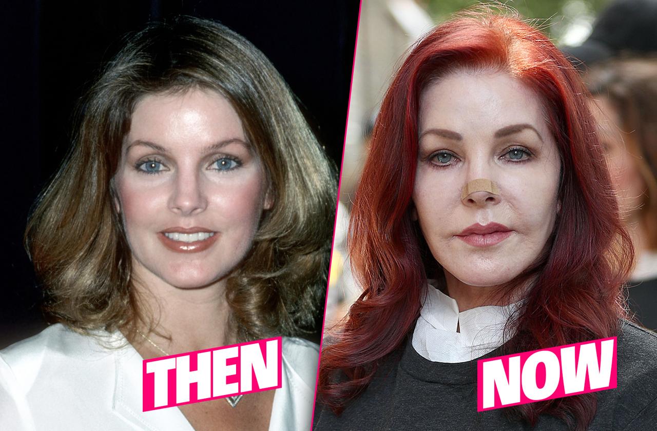 Priscilla Presley Ruins Looks After Skin Cancer Surgery Drama