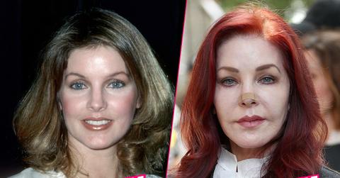 Priscilla Presley Ruins Looks After Skin Cancer Surgery Drama