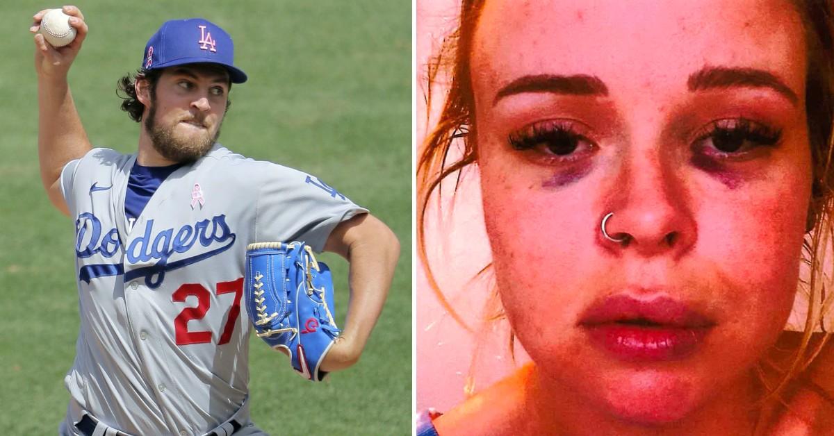 Who is Lindsey Hill? Trevor Bauer's Sexual Assault Accuser Faces Lawsuit