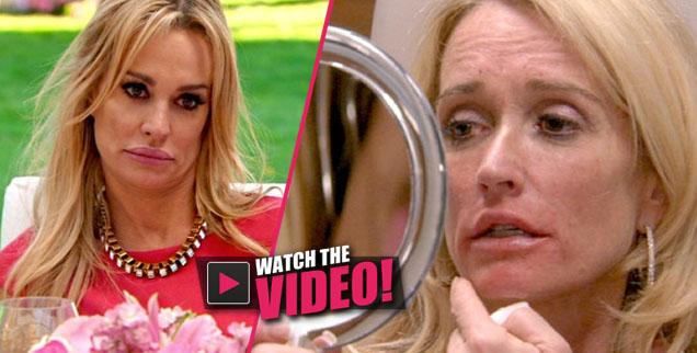 //kim richards asks taylor armstrong for lip injection tips