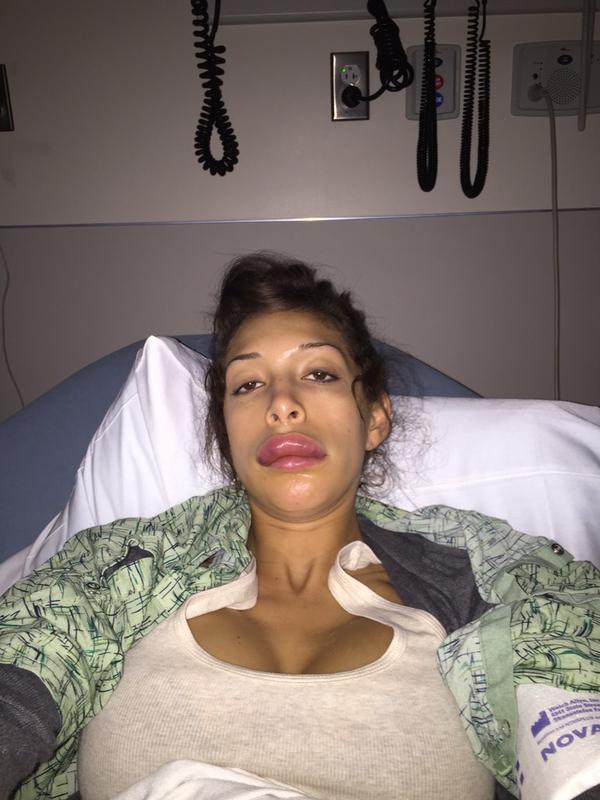 //farrah abraham lip injections fixed