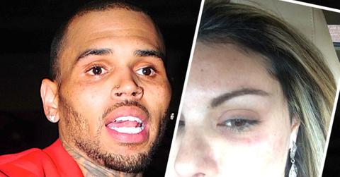 Chris Brown Accused Of Punching Woman In The Face In Las Vegas