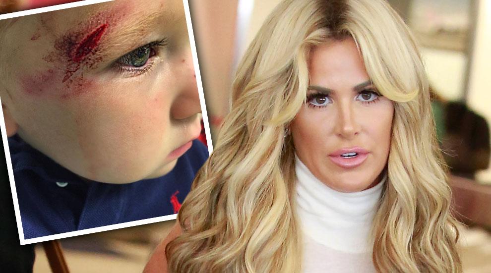 Kim Zolciak Son Kane Injury