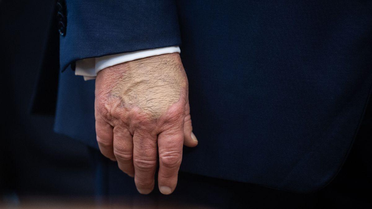 A photo of Donald Trump's hand
