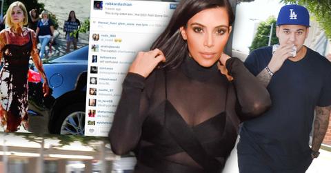 //rob kardashian deletes post slider