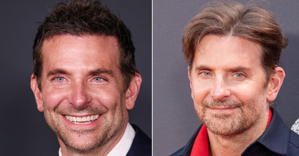 Bradley Cooper’s Plastic Surgery Disaster! Inside His Bizarre New Look