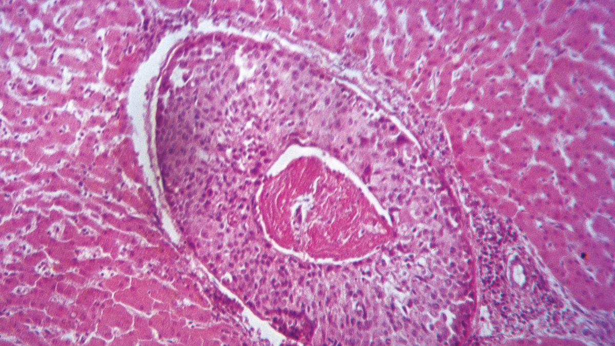 Soviet researchers cited Myracyl D and Guanozolo as compounds that could target both parasites and tumor growth in early experiments.