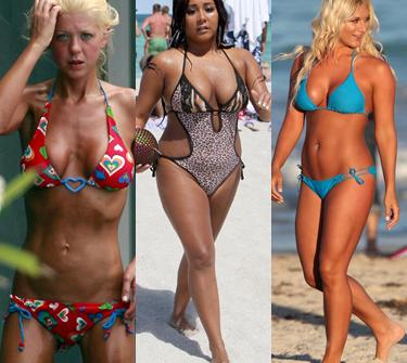 PHOTOS The Best & Worst Bikini Suntans -- & Burns -- On The Be