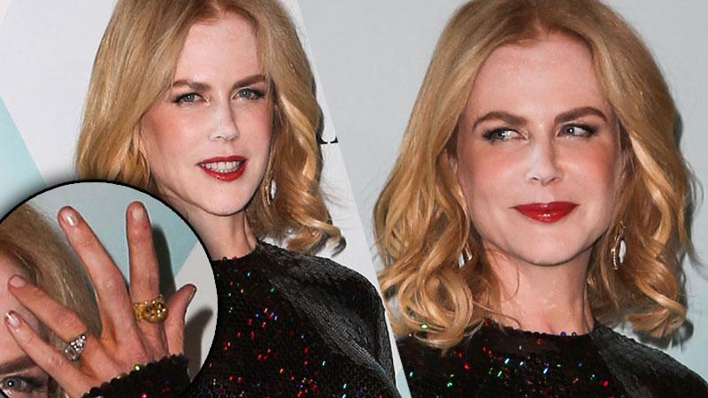 Nicole Kidman White Powder Nose Dirty Nails Photos