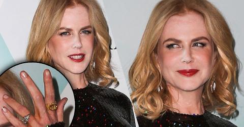 Nicole Kidman White Powder Nose Dirty Nails Photos