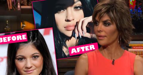 Lisa Rinna Kylie Jenner Lips