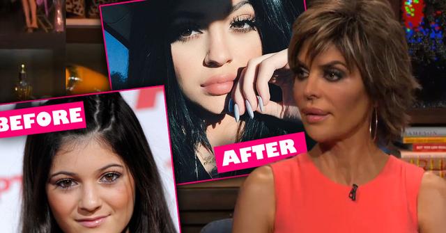 Lisa Rinna Kylie Jenner Lips