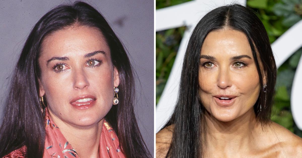 Demi Moore's Shocking New Face, Plastic Surgeons Weigh In