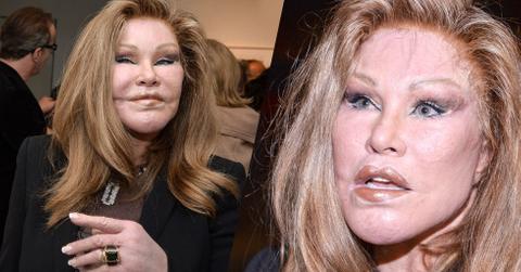 Jocelyn Wildenstein Plastic Surgery Photos