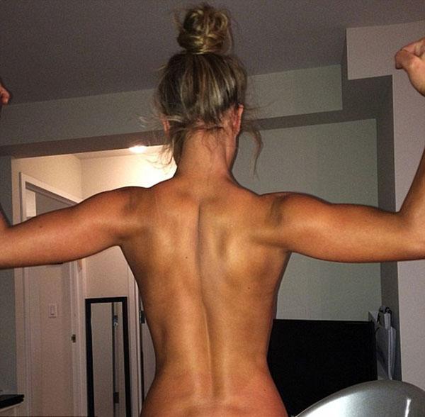 Sexiest Sunburn Ever! Peeling Nina Agdal Covers Breasts With Hands In Racy  Instagram Shot