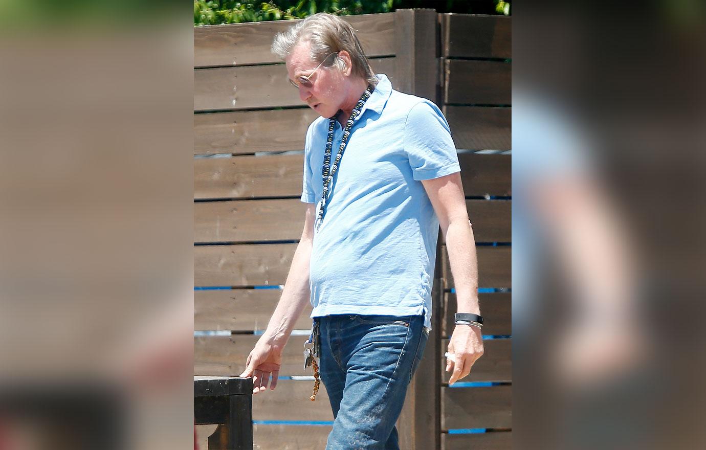 val kilmer flesh eating disease cancer hell horrifying photos