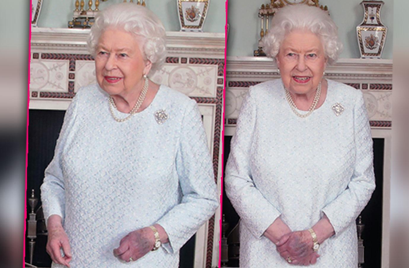 Queen Elizabeth Bruised Purple Hand Photos