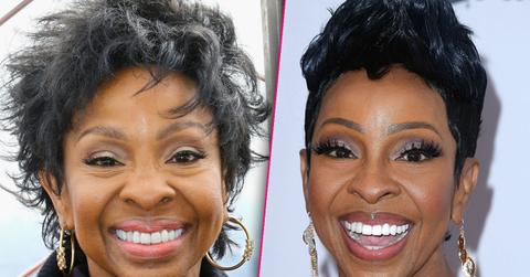 Gladys Knight Plastic Surgery