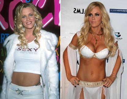 //jenny mccarthy plastic surgery by age