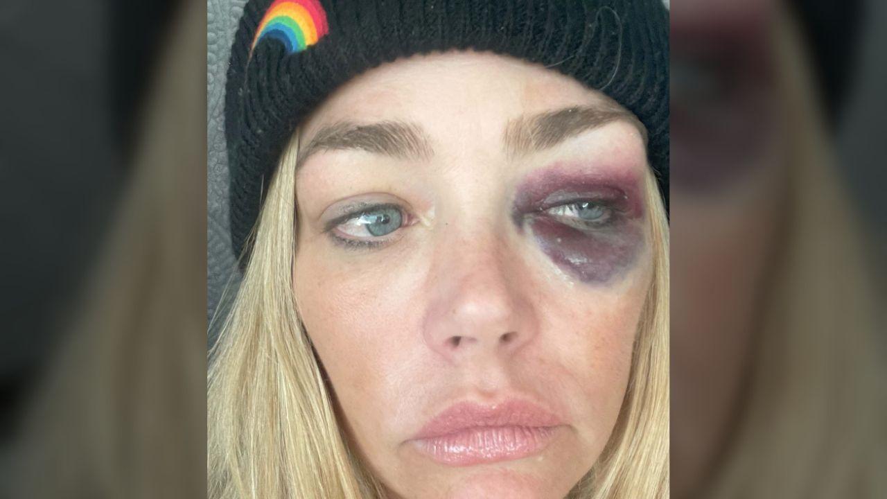 Photo of Denise Richards