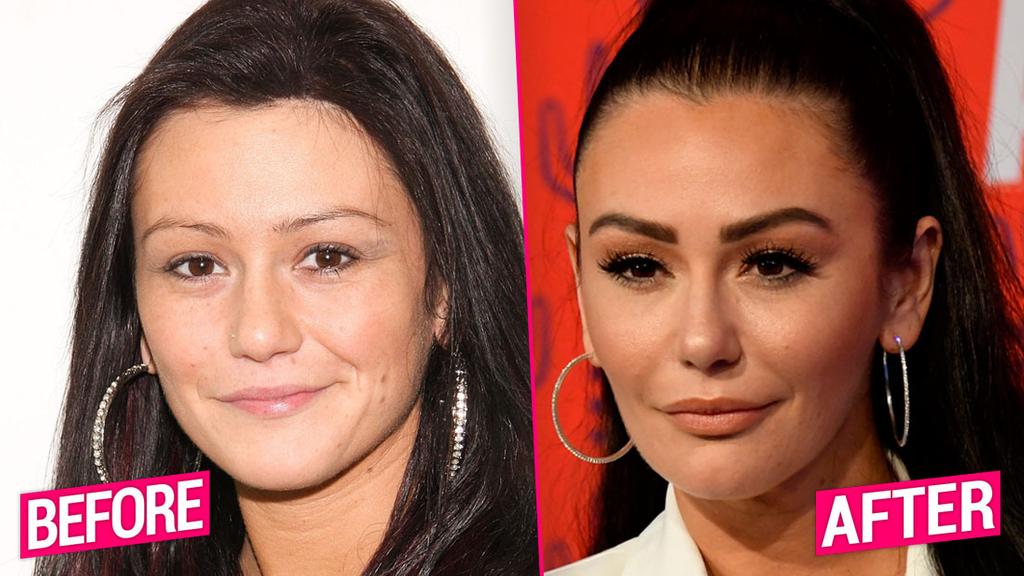 'Jersey Shore' Cast's Shocking Plastic Surgery Transformations Revealed