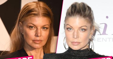 Fergie Josh Duhamel Divorce Plastic Surgery