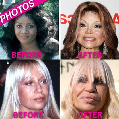 Plastic Surgery Disasters And Triumphs For Stars Over 50