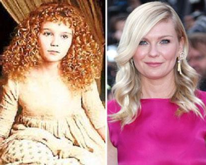 //kirsten dunst child star plastic surgery