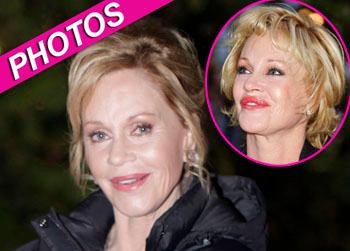 //melanie griffith platic surgery face getty flynet