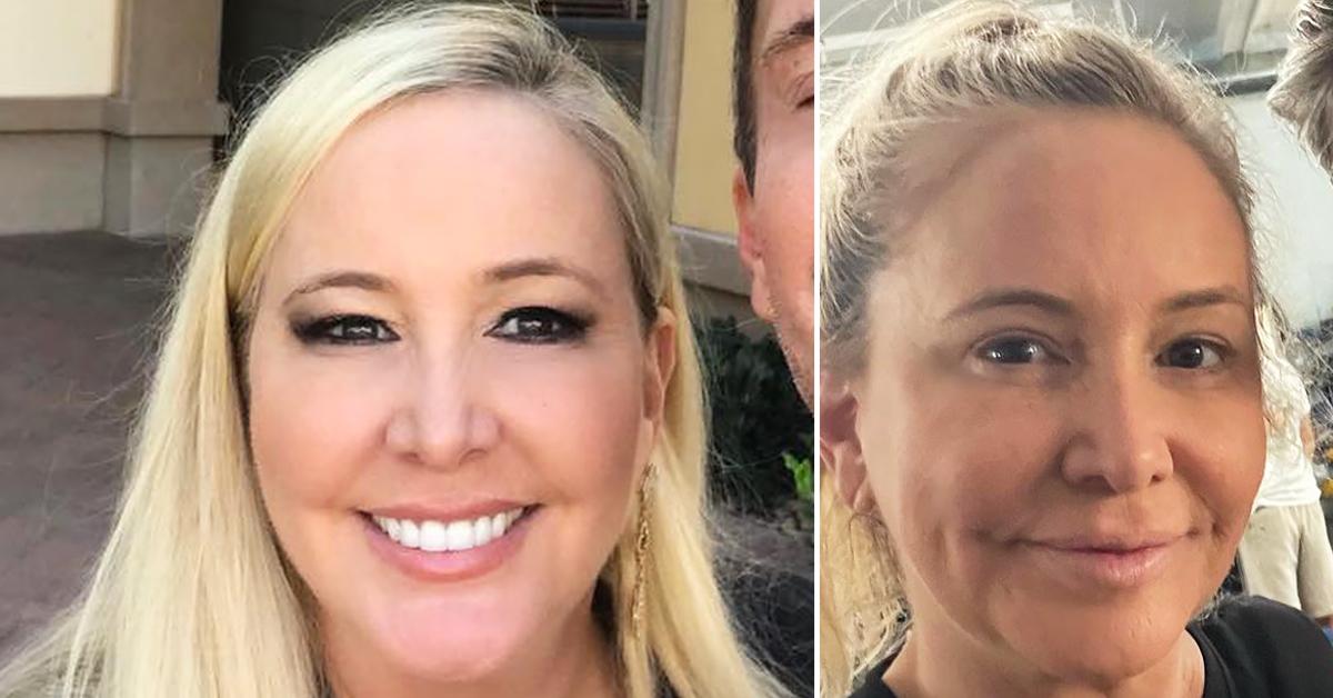 shannon beador face inject filler nightmare video instagram filter rhoc r