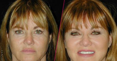 //rhoc Jeana Keough plastic surgery makeover pp